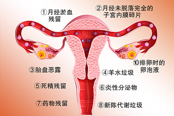 手脚冰凉、宫冷宫寒案例